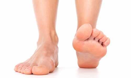 Плоскостопие у взрослых фото отпечатков ног